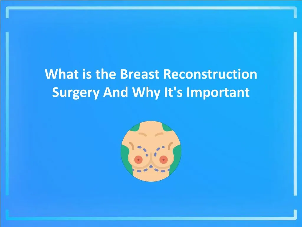 what is the breast reconstruction surgery