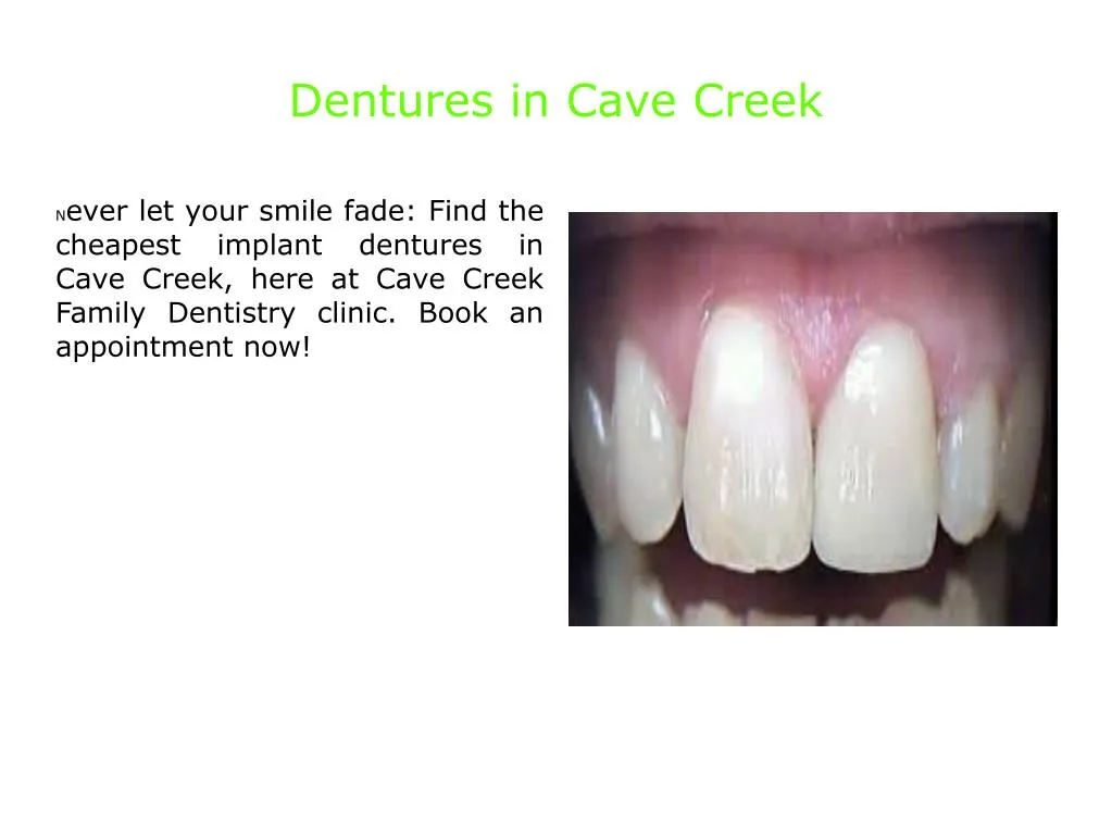 dentures in cave creek