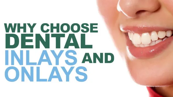 Why Choose Dental Inlays and Onlays