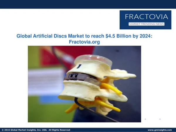 Artificial Disc Market to grow at 21% CAGR from 2016 to 2024