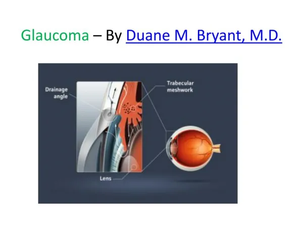 Glaucoma – By Duane M. Bryant, M.D.