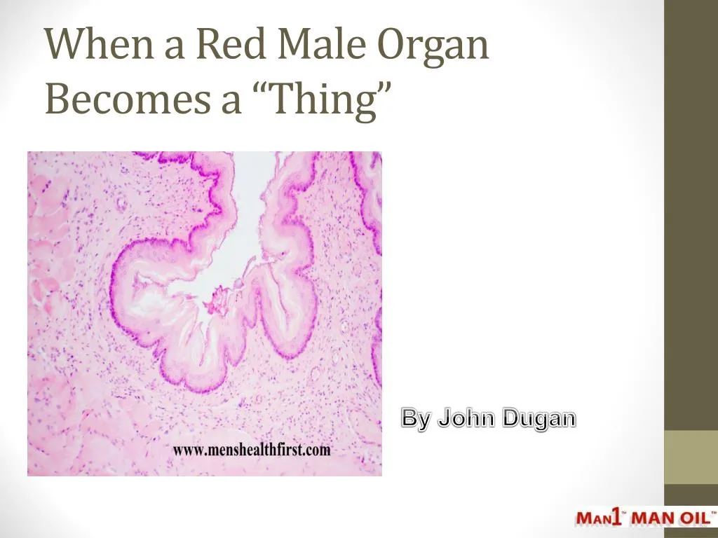 when a red male organ becomes a thing