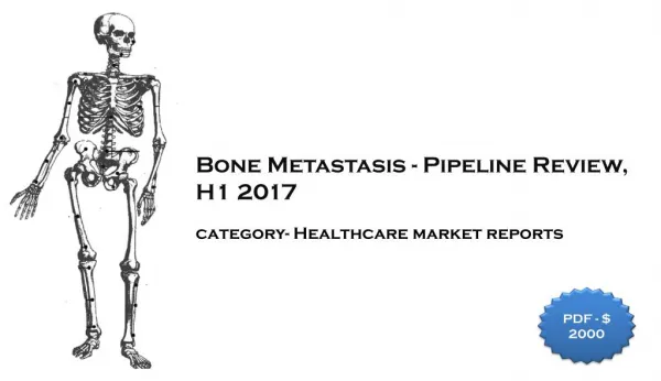 Bone Metastasis - Pipeline Review, H1 2017: Aarkstore