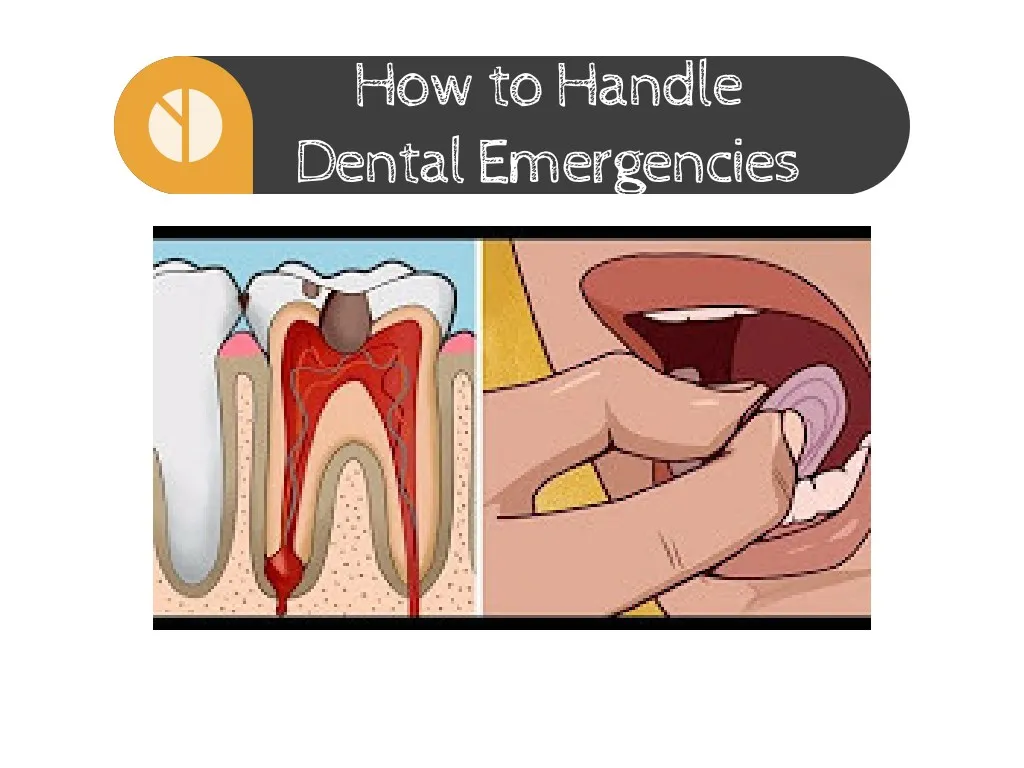 how to handle dental emergencies
