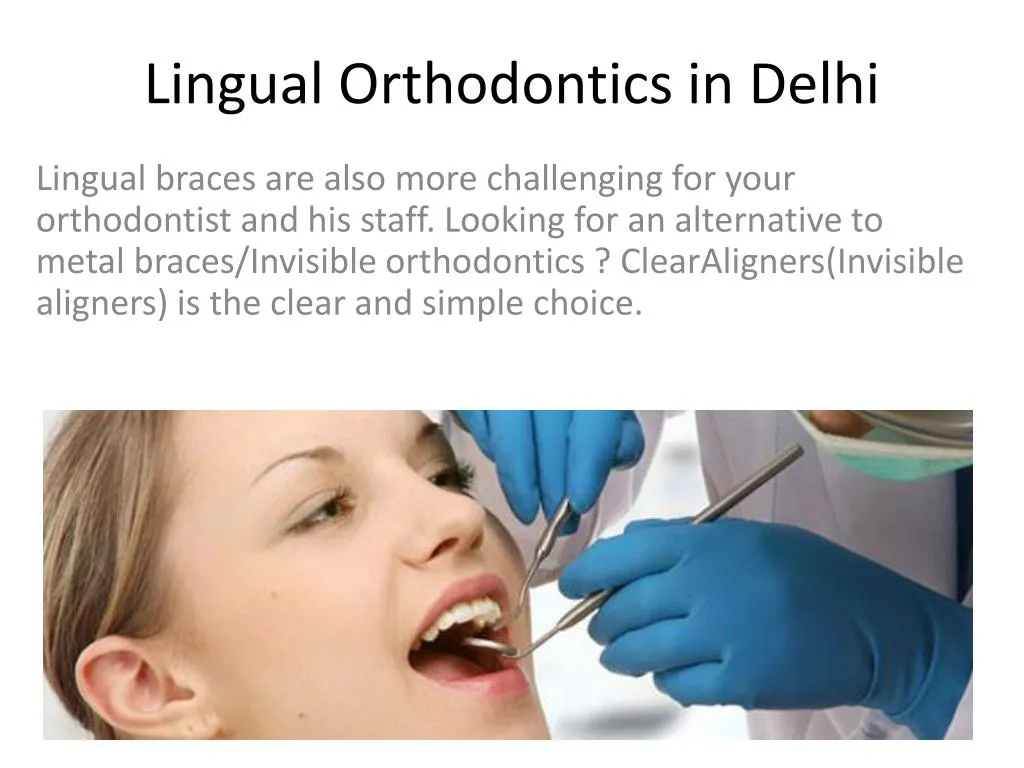lingual orthodontics in delhi