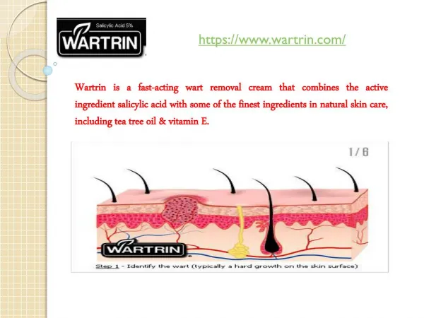 Genital Wart Removal Cream