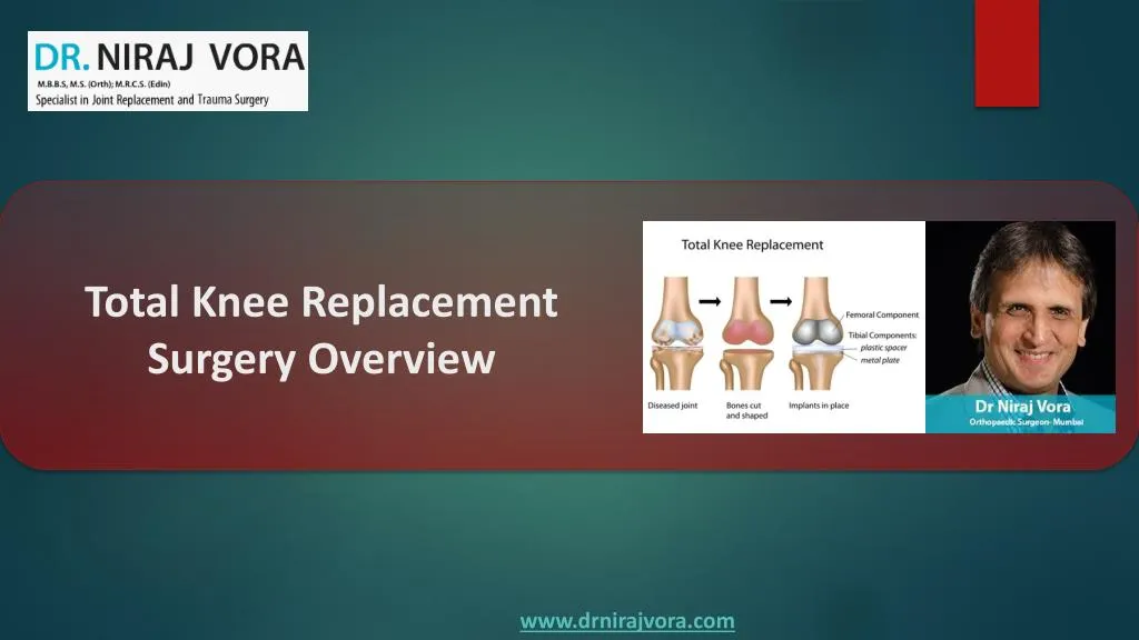 total knee replacement surgery overview