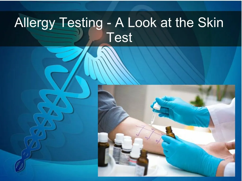 allergy testing a look at the skin test