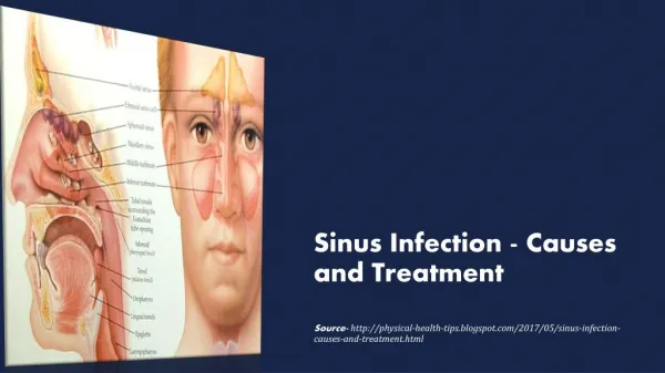 Sinus Infection - Causes and Treatment