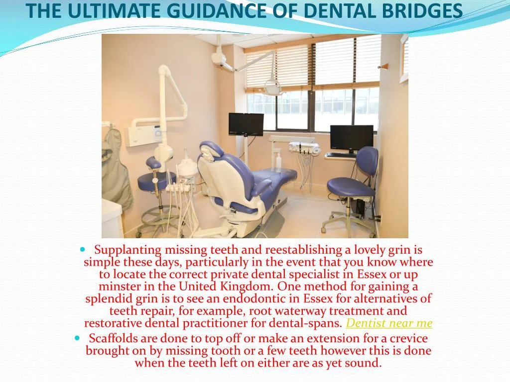 the ultimate guidance of dental bridges