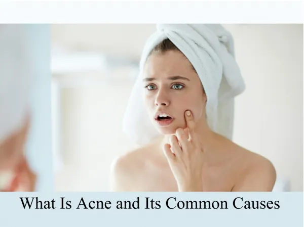 What Is Acne and Its Common Causes
