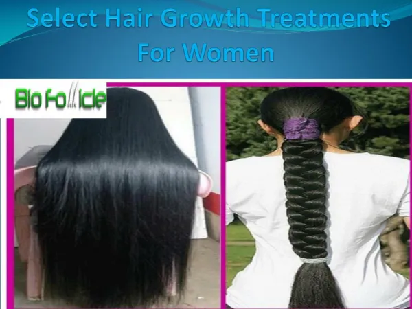 Select Hair Growth Treatments For Women