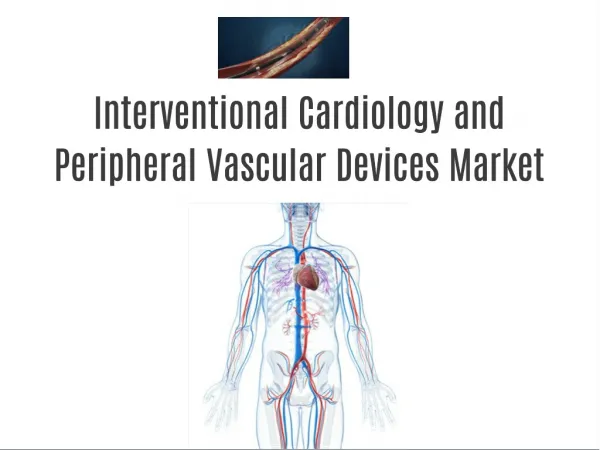 Interventional Cardiology and Peripheral Vascular Devices Market