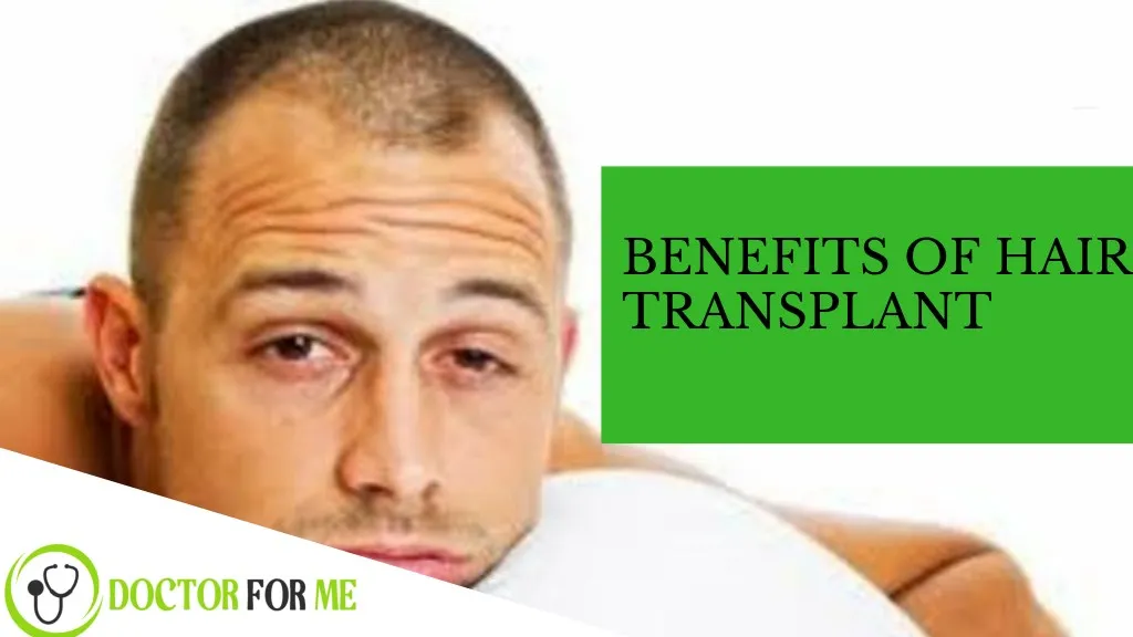 benefits of hair transplant