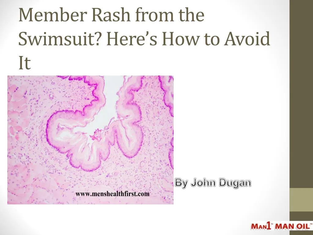 member rash from the swimsuit here s how to avoid it
