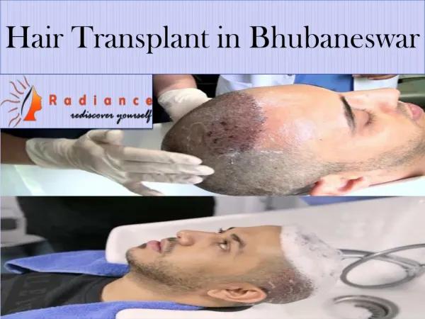Hair Transplantation in Bhubaneswar