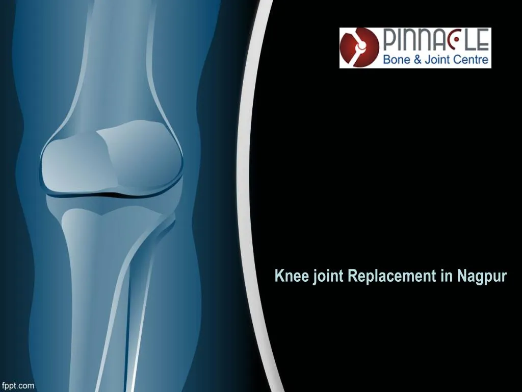 knee joint replacement in nagpur