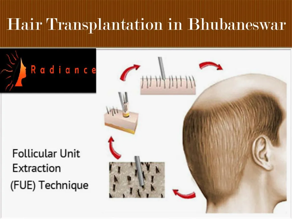 hair transplantation in bhubaneswar