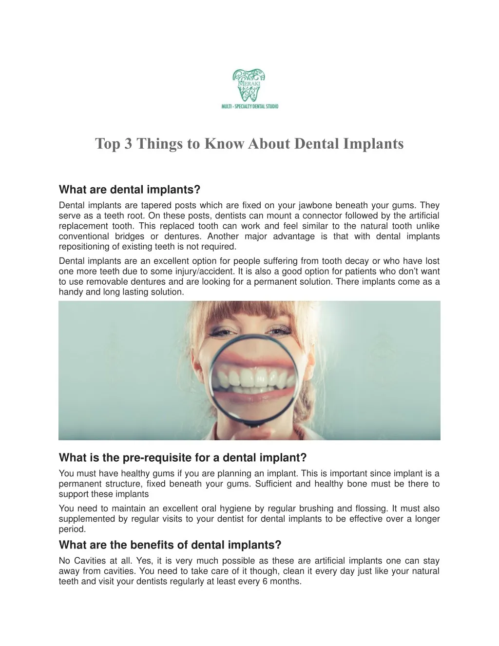 top 3 things to know about dental implants