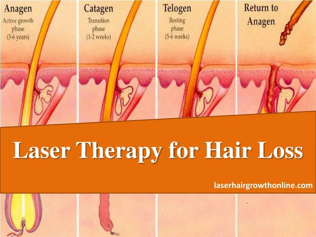 laser therapy for hair loss