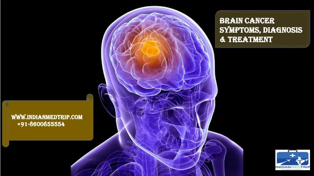 brain cancer symptoms diagnosis treatment