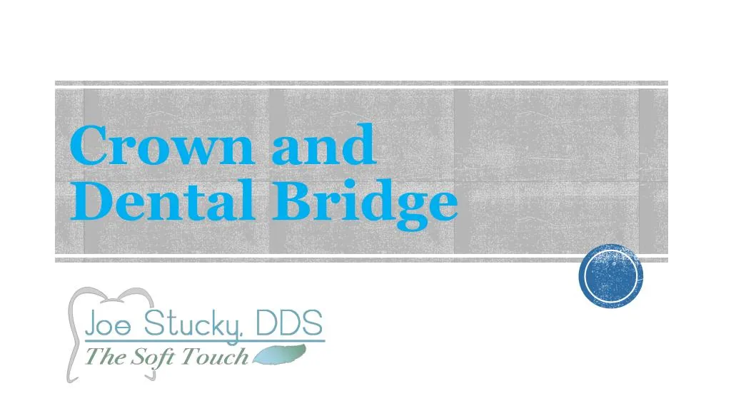 crown and dental bridge
