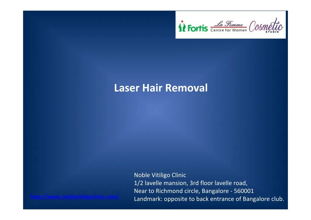 laser hair removal