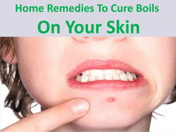 Home remedies to cure boils on your skin
