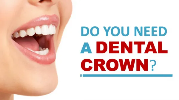 Do You Need a Dental Crown