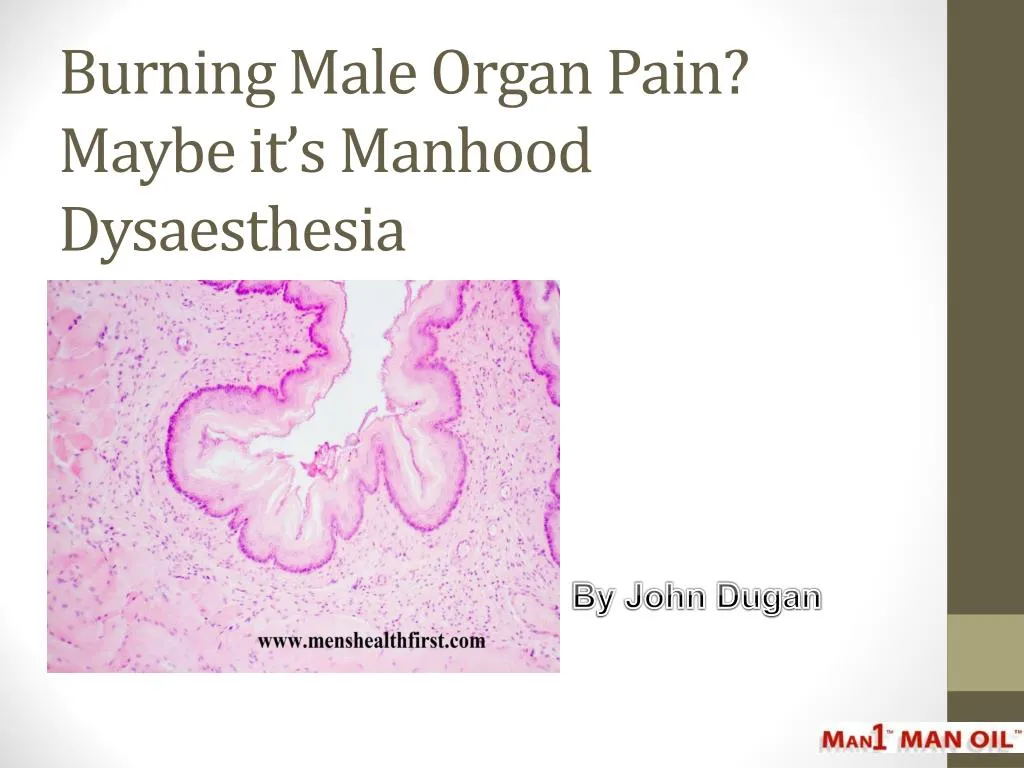 burning male organ pain maybe it s manhood dysaesthesia