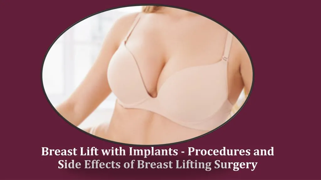 breast lift with implants procedures and side effects of breast lifting surgery