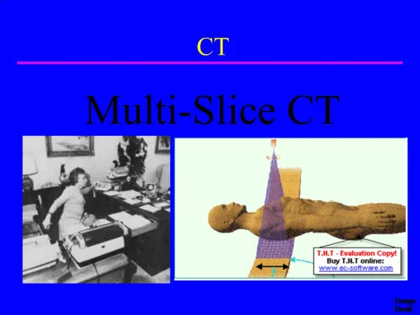 Multi-Slice CT