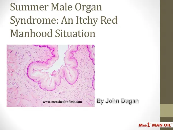 Summer Male Organ Syndrome: An Itchy Red Manhood Situation