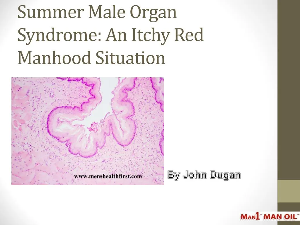 summer male organ syndrome an itchy red manhood situation