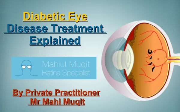 Diabetic Eye Disease Treatment Explained