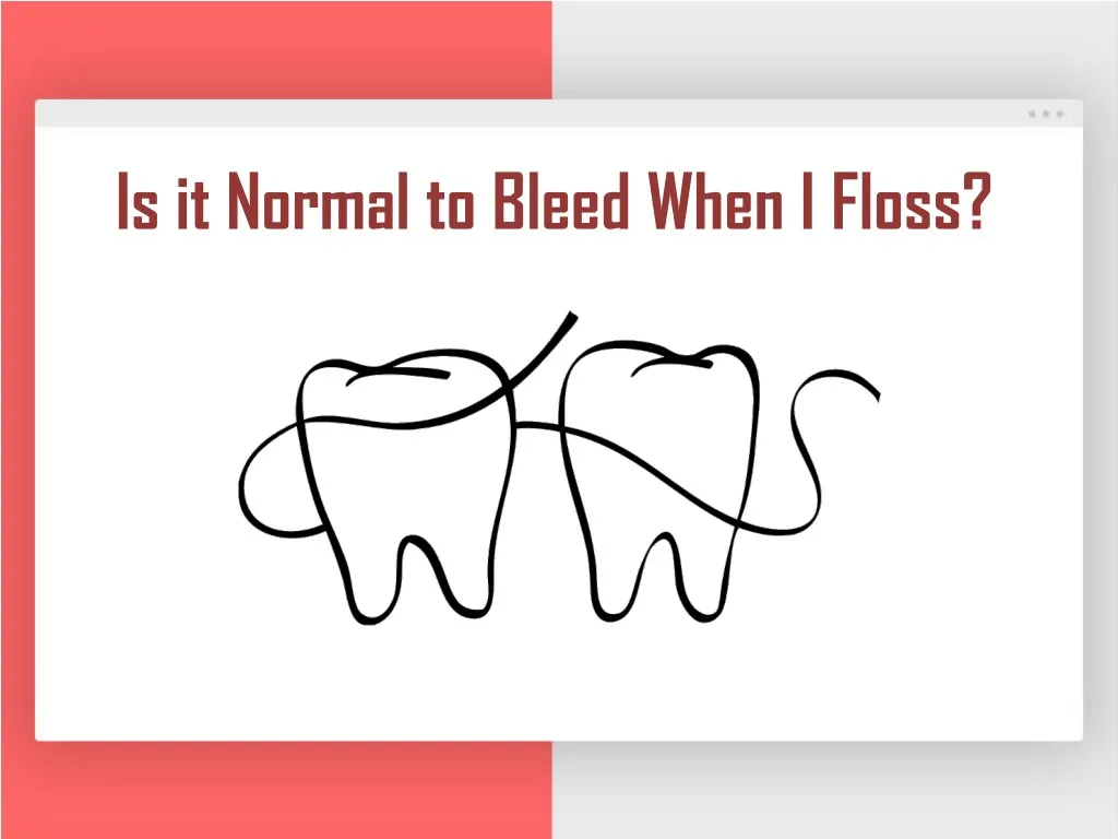 is it normal to bleed when i floss