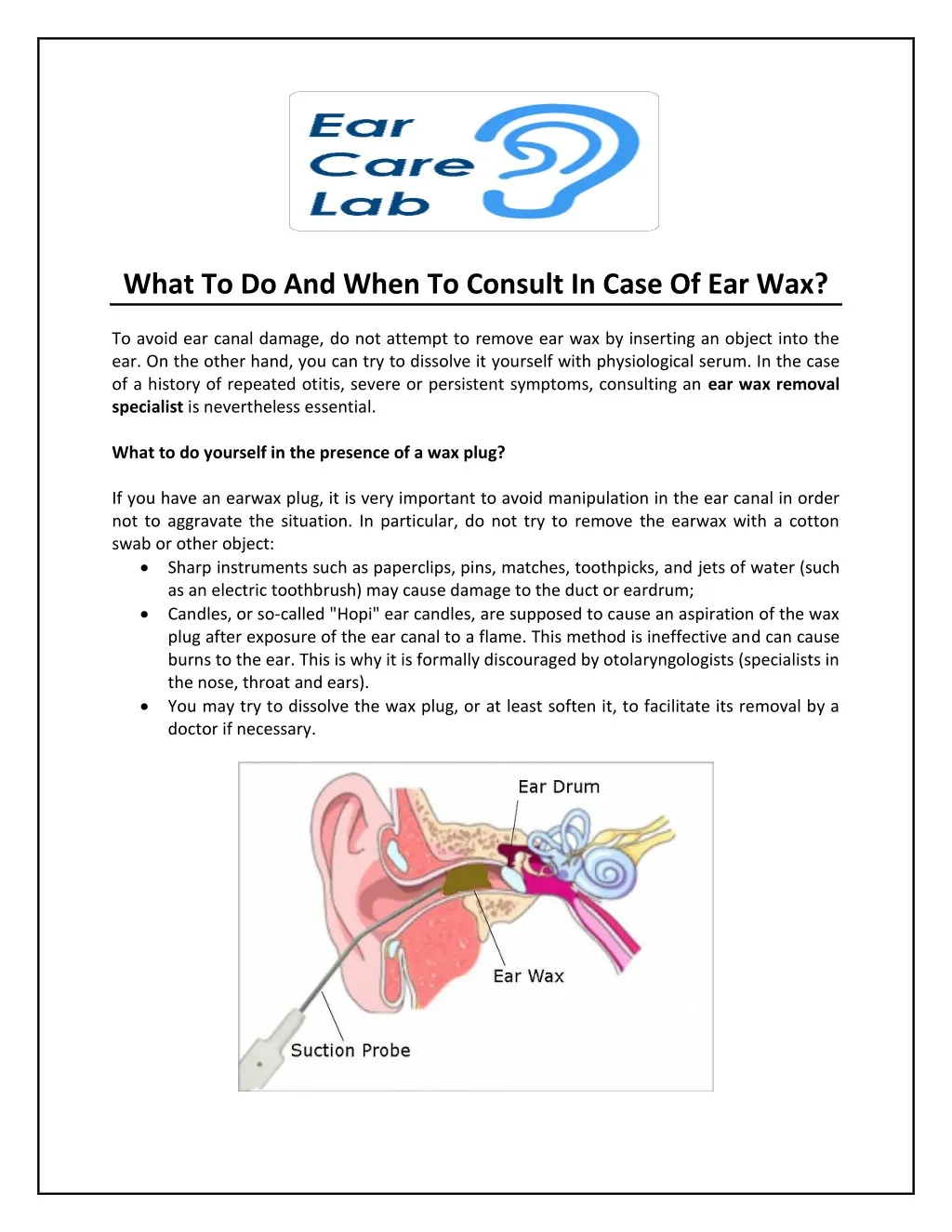 what to do and when to consult in case of ear wax