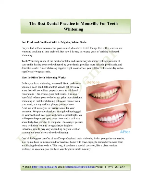 The Best Dental Practice in Montville For Teeth Whitening