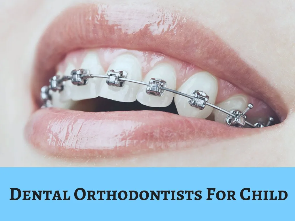 dental orthodontists for child