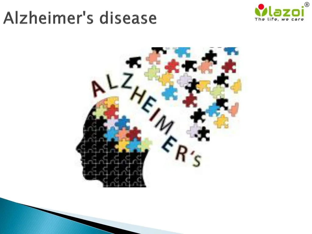 alzheimer s disease