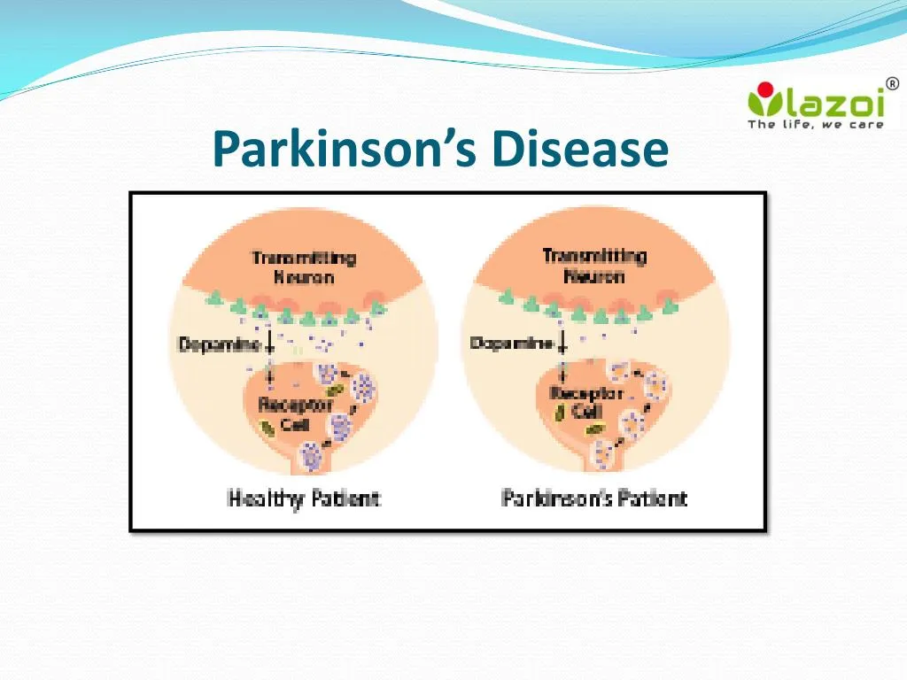 parkinson s disease