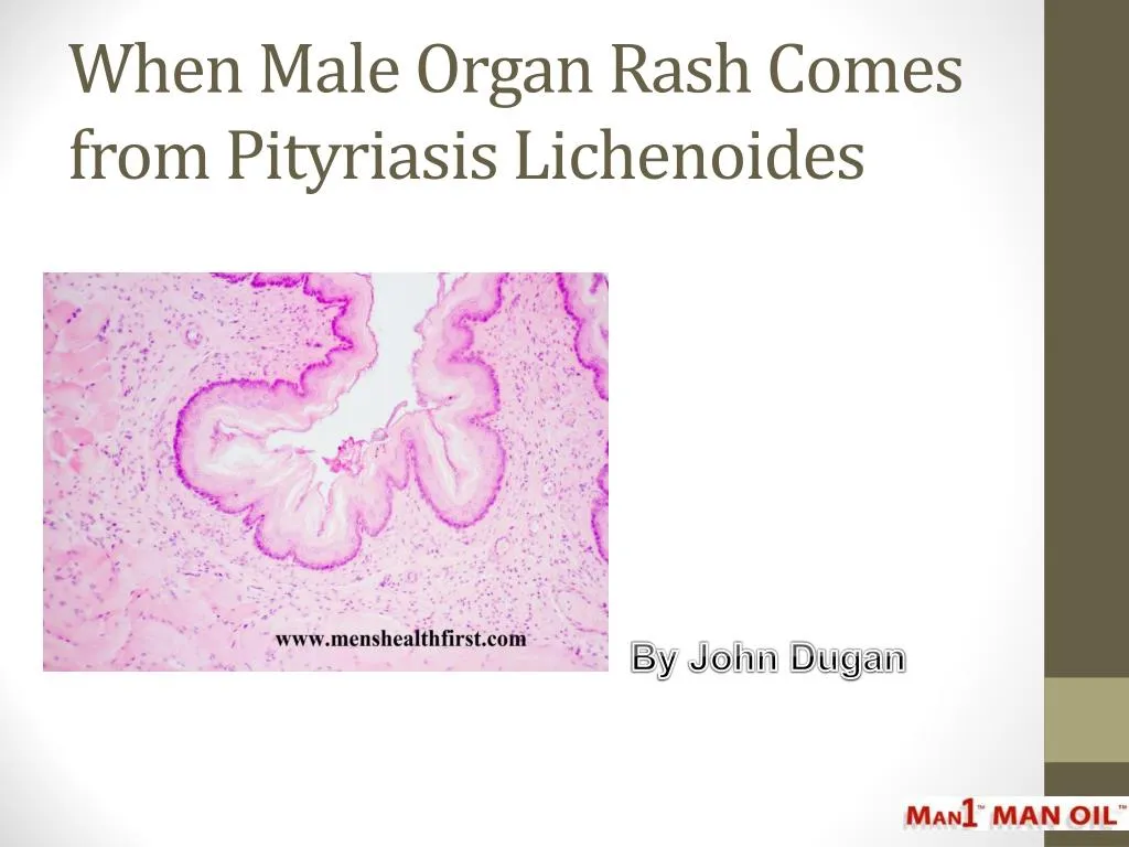 when male organ rash comes from pityriasis lichenoides