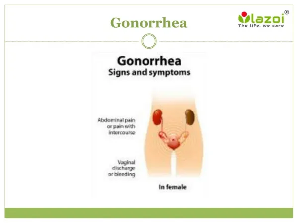 Gonorrhea: Overview, symptoms, causes, diagnosis, treatment and prevention
