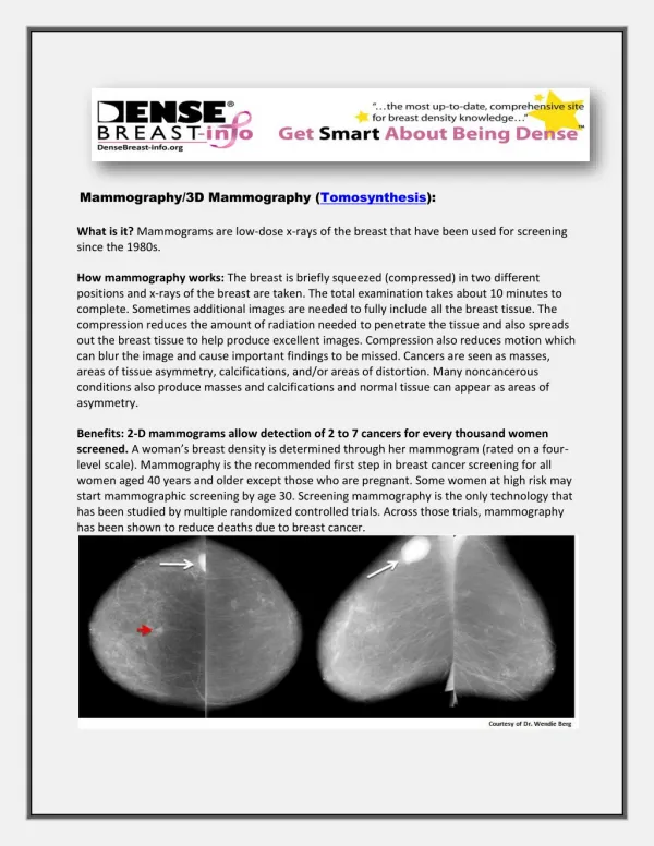 Tomosynthesis | Dense Breast Info Inc.