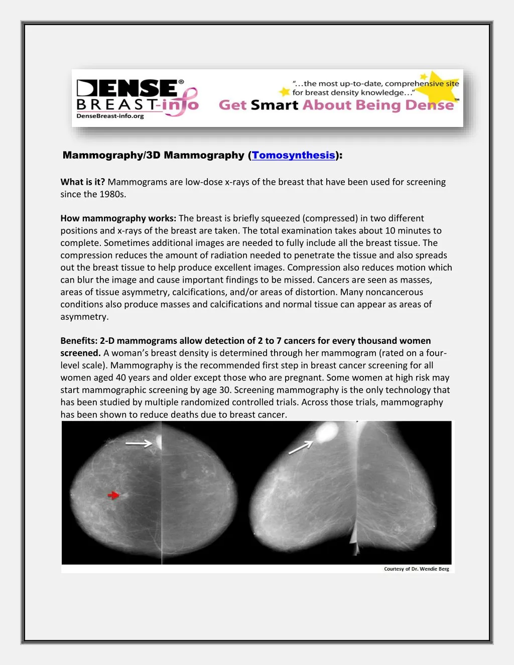 mammography 3d mammography tomosynthesis