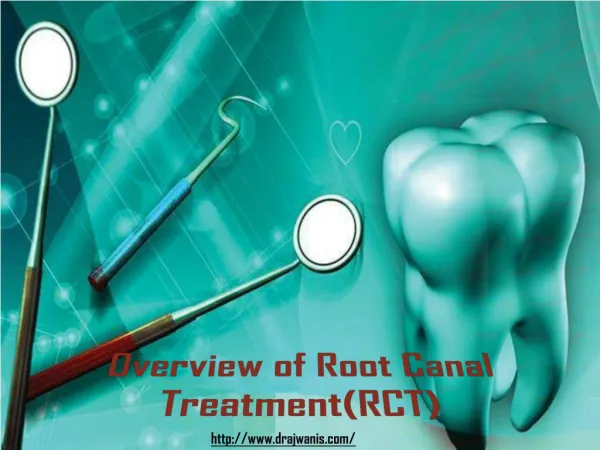 Overview of Root Canal Treatment By Dr. Ajwani