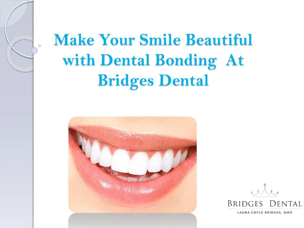 make your smile beautiful with dental bonding at bridges dental