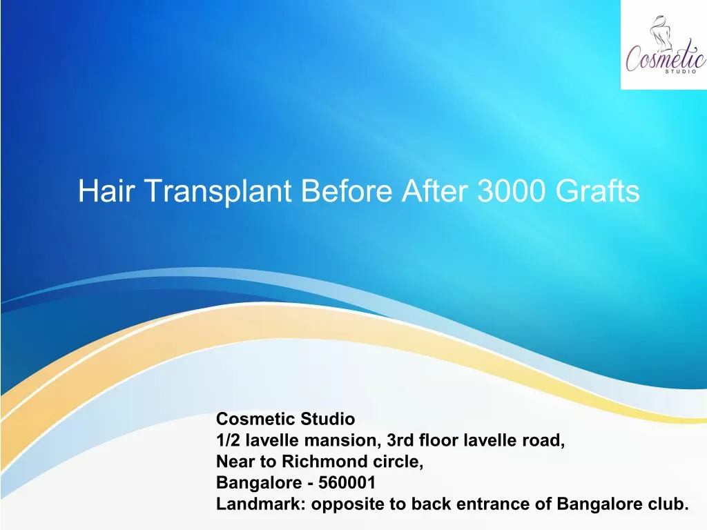 hair transplant before after 3000 grafts