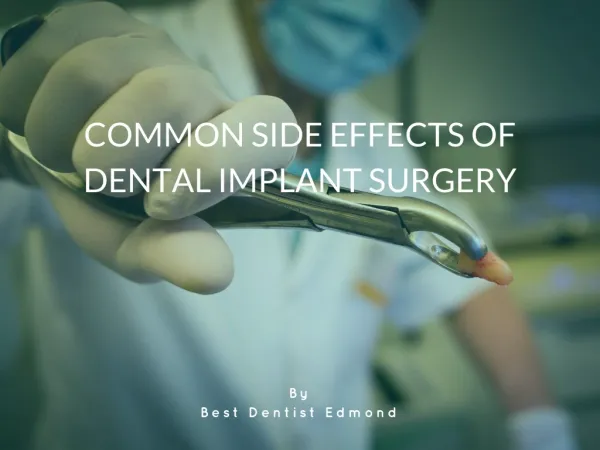 Common Side Effects of Dental Implant Surgery