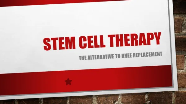 Stem Cell Therapy: The Alternative to Knee Replacement